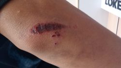 Percobaan Begal di Jalan Tinumbu Makassar, Korban Alami Luka dan Motor Dirusak