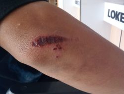 Percobaan Begal di Jalan Tinumbu Makassar, Korban Alami Luka dan Motor Dirusak