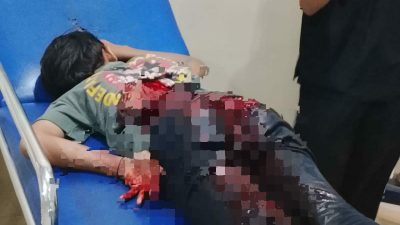 Makassar Tidak Aman! Anggota Genk Motor Tebas Anak 13 Tahun di Makassar